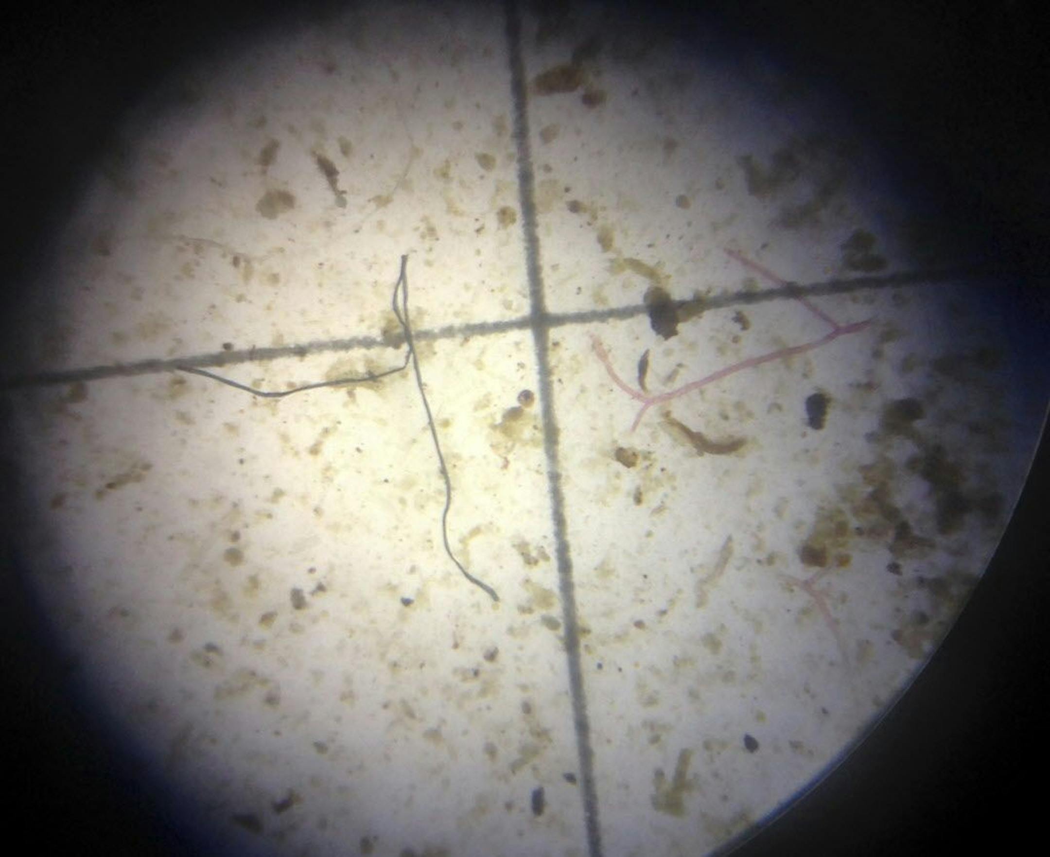 In this, Tuesday, Feb. 7, 2017 photo, a possible plastic microfiber, left, is shown through a microscope during an examination of nearby ocean water in Key Largo, Fla. Gulf Coast researchers are preparing to launch a two-year study to see what kinds of microscopic plastics can be found in the waters from south Texas to the Florida Keys. The project will expand a year's worth of data collected around the state of Florida that predominantly found microfibers, shreds of plastic even smaller than th