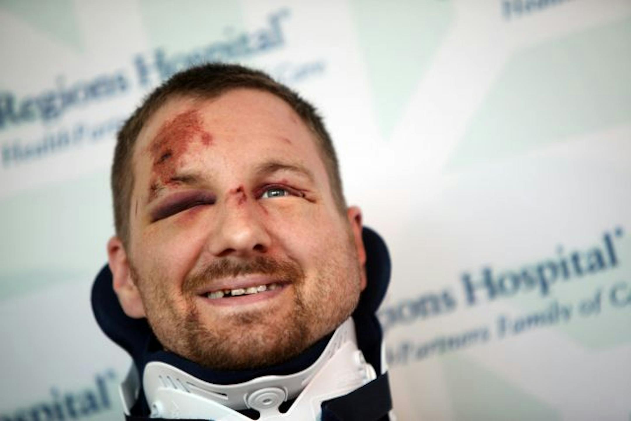 Beaten for intervening: Eric Skripka explained why he got involved: "If it was my sister or my friend getting assaulted, I'm going to do what I can."