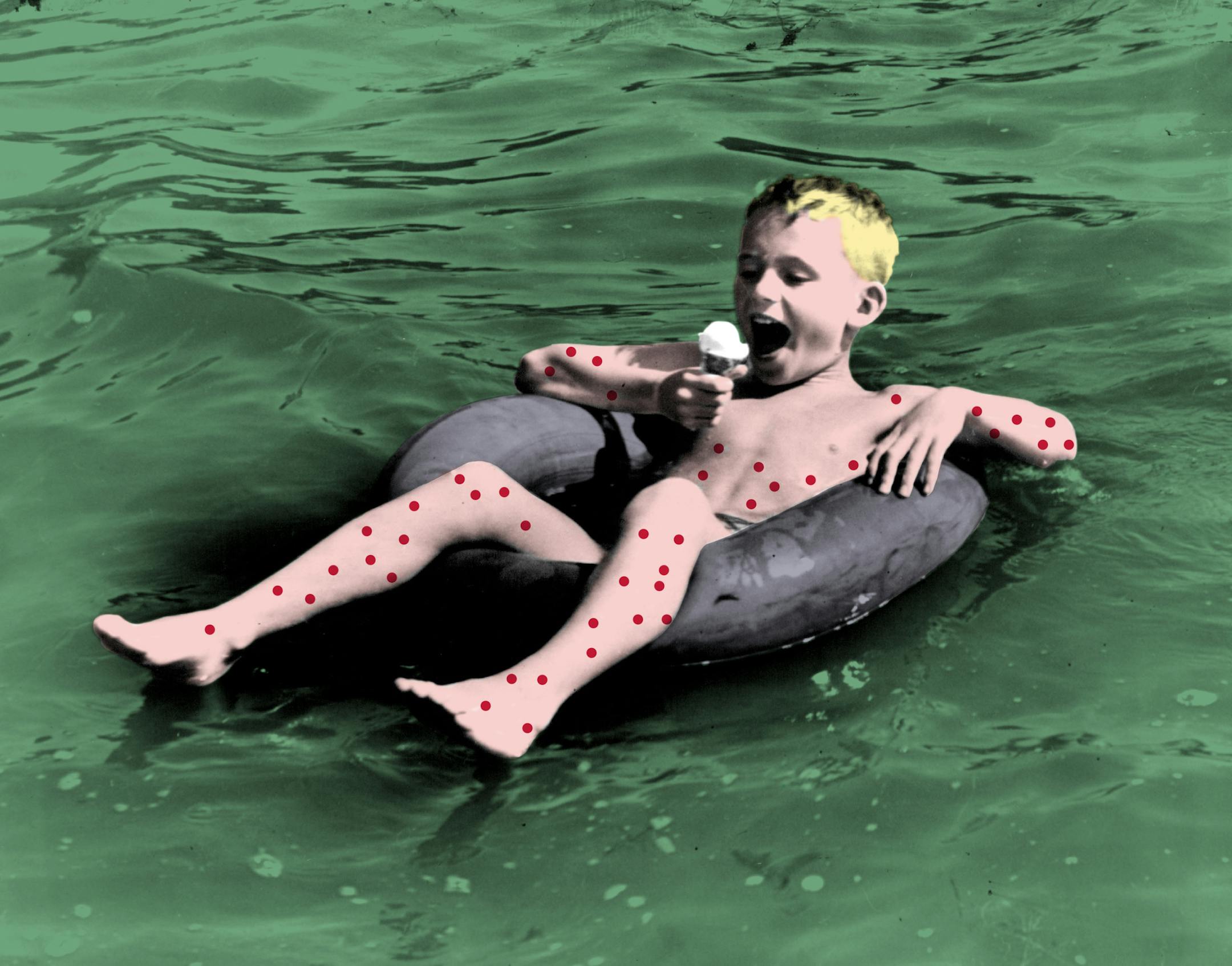 Swimmers itch illustration Star Tribune illustration / Star Tribune file photo ORG XMIT: MIN2016062415221066
