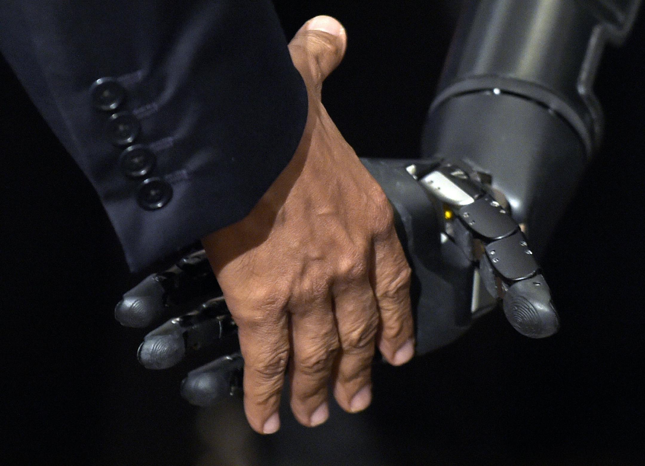 President Barack Obama shakes hands with Nathan Copeland during a tour of innovation projects at the White House Frontiers Conference at University of Pittsburgh in Pittsburgh, Thursday, Oct. 13, 2016. Copeland demonstrates how he can control a robotic arm and feel when the robotic hand is touched. (AP Photo/Susan Walsh)