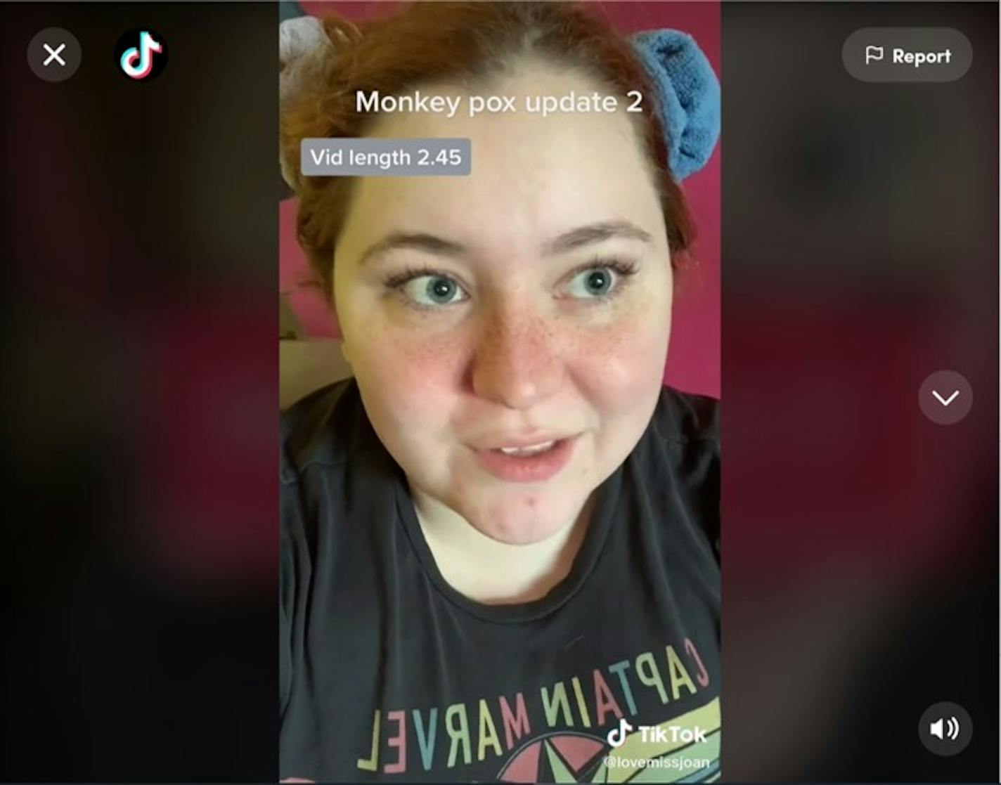 Joan Sullivan, of Minneapolis, has been making TikTok videos about the challenges of getting a test for monkeypox.