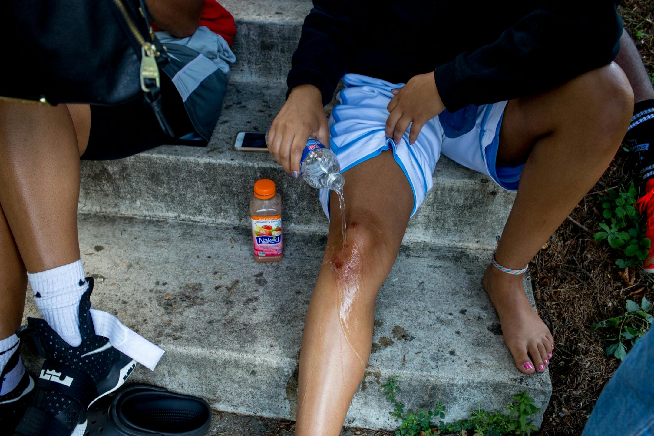 Senior Chimali Daypour pours water on the knee she cut during the partial building collapse at Minnehaha Academy. Day was in her junior counseling meeting during the collapse on Aug. 2, 2017.