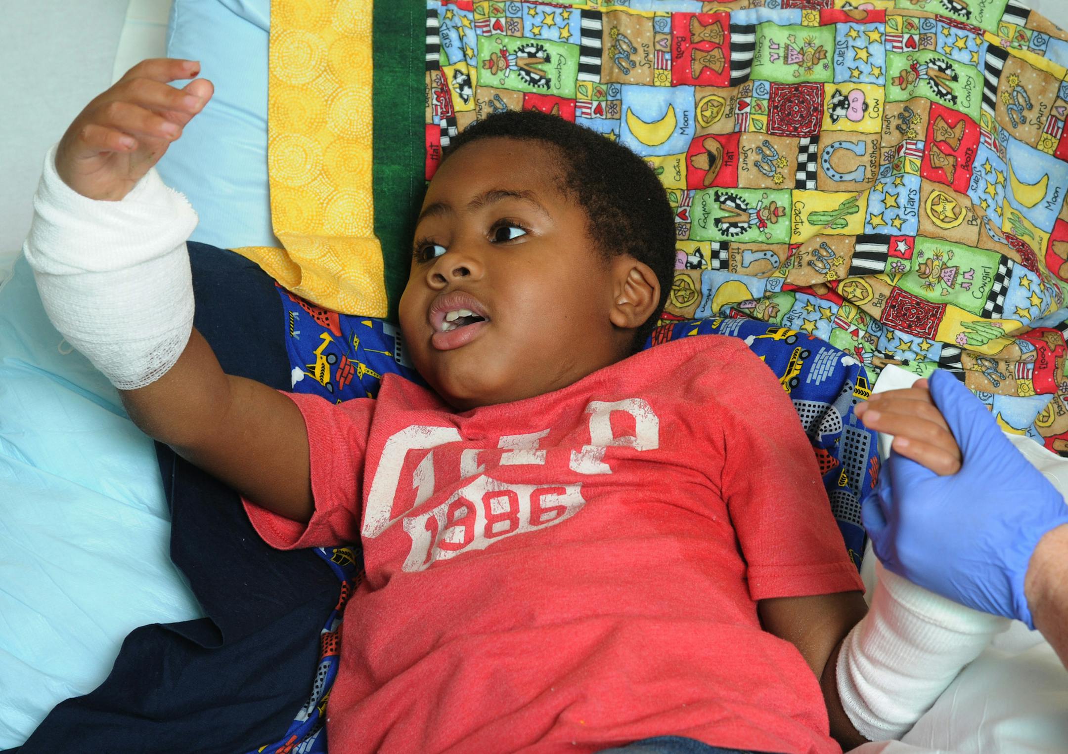 Zion Harvey, 8, of Baltimore, seems to marvel at his new right hand while in his hospital bed on July 27, 2015. Zion lost his hands and feet to a bacterial disease when he was 2, but had a double hand transplant at Children's Hospital of Philadelphia in early July 2015, the first pediatric double hand transplant. (Clem Murray/Philadelphia Inquirer/TNS)