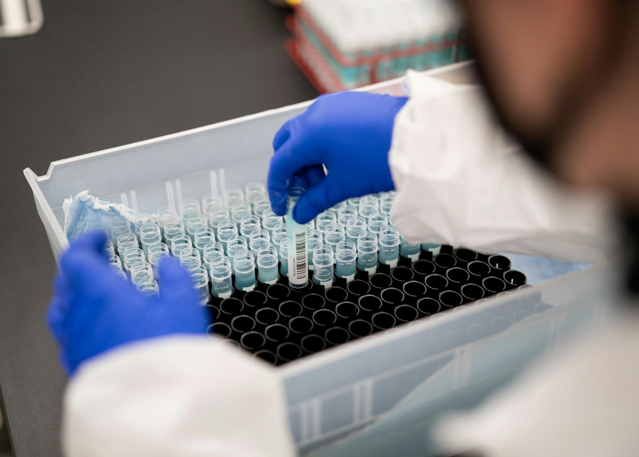 Samantha Brandt uncapped saliva samples, checked the volume for each sample, and prepared them for extraction.