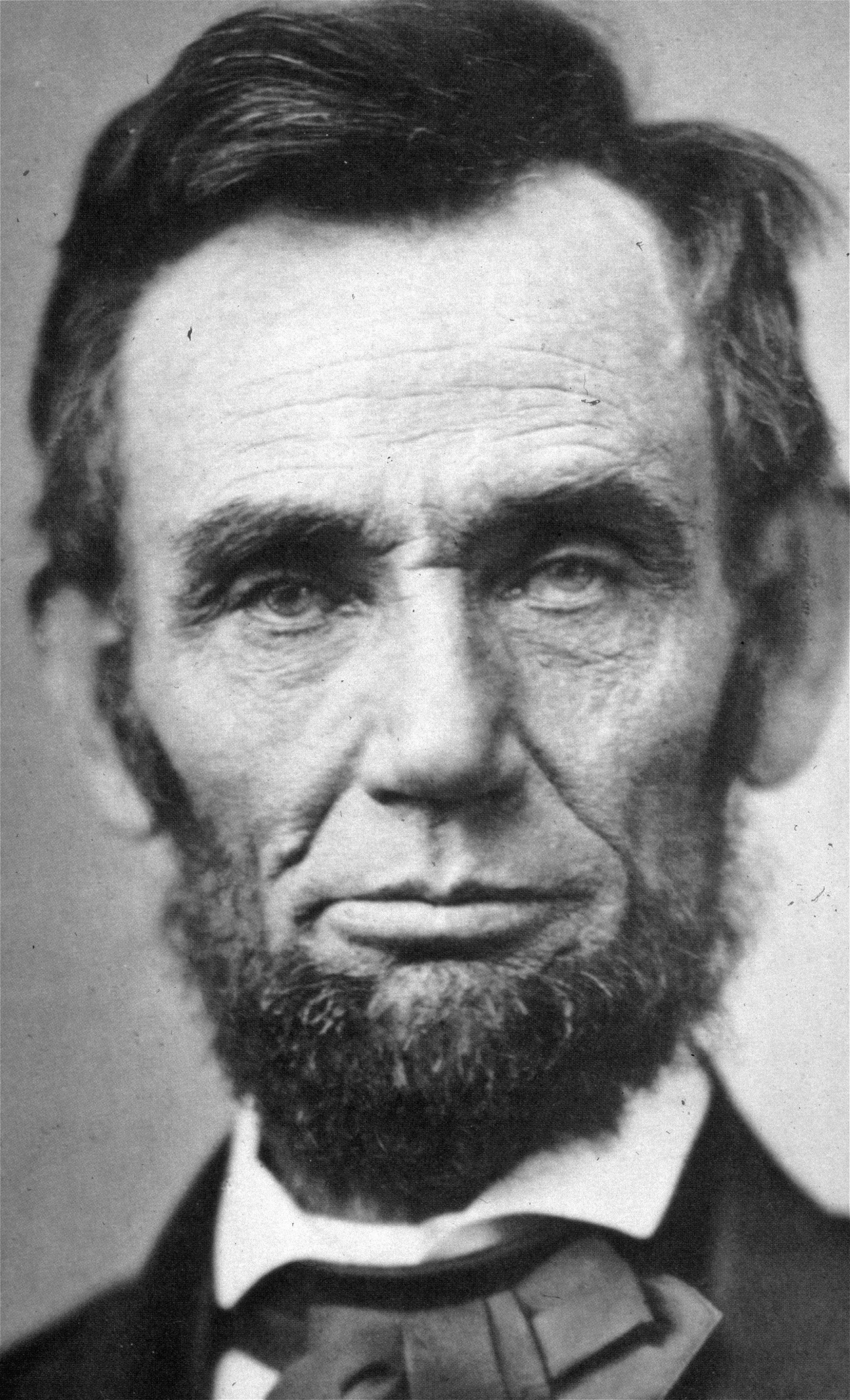 President Abraham Lincoln is shown in this Nov. 8, 1863 file photo made available by the New York Public Library. Lincoln has been dead for 142 years, but he still manages to make medical headlines, this time from doctors who say he had a bad case of smallpox when he delivered the Gettysburg Address.