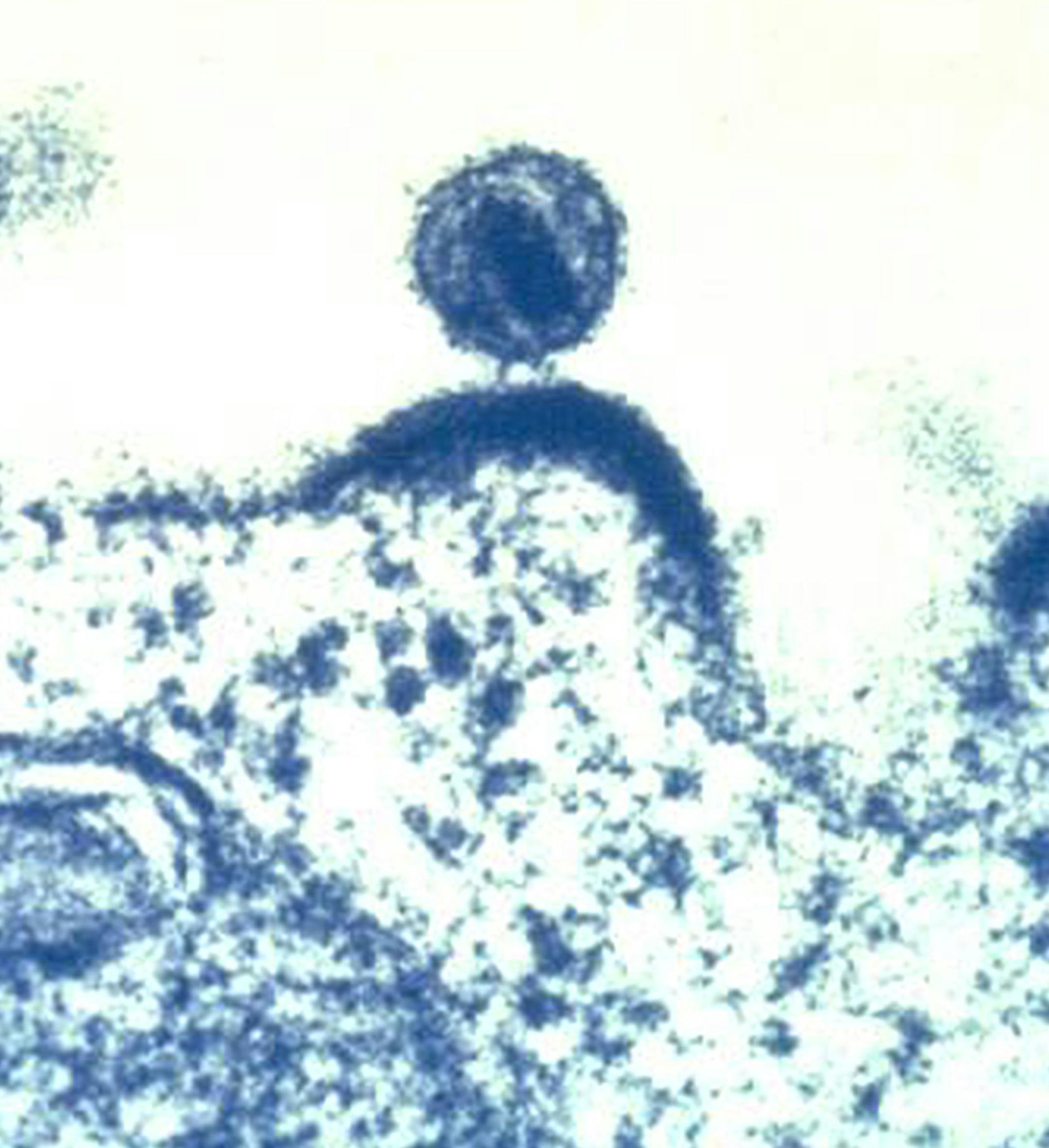 This Feb. 3, 2012 microscope image made available by the National Institute of Allergy and Infectious Diseases shows a human immunodeficiency virus (HIV) budding out of a human immune cell, which the virus infects and uses to replicate. Doctors may one day be able to control a patientís HIV infection in a new way: injecting swarms of germ-fighting antibodies, two new studies suggest. Reports by Dr. Dan Barouch of Harvard and the Beth Israel Deaconess Medical Center in Boston and the Nationa