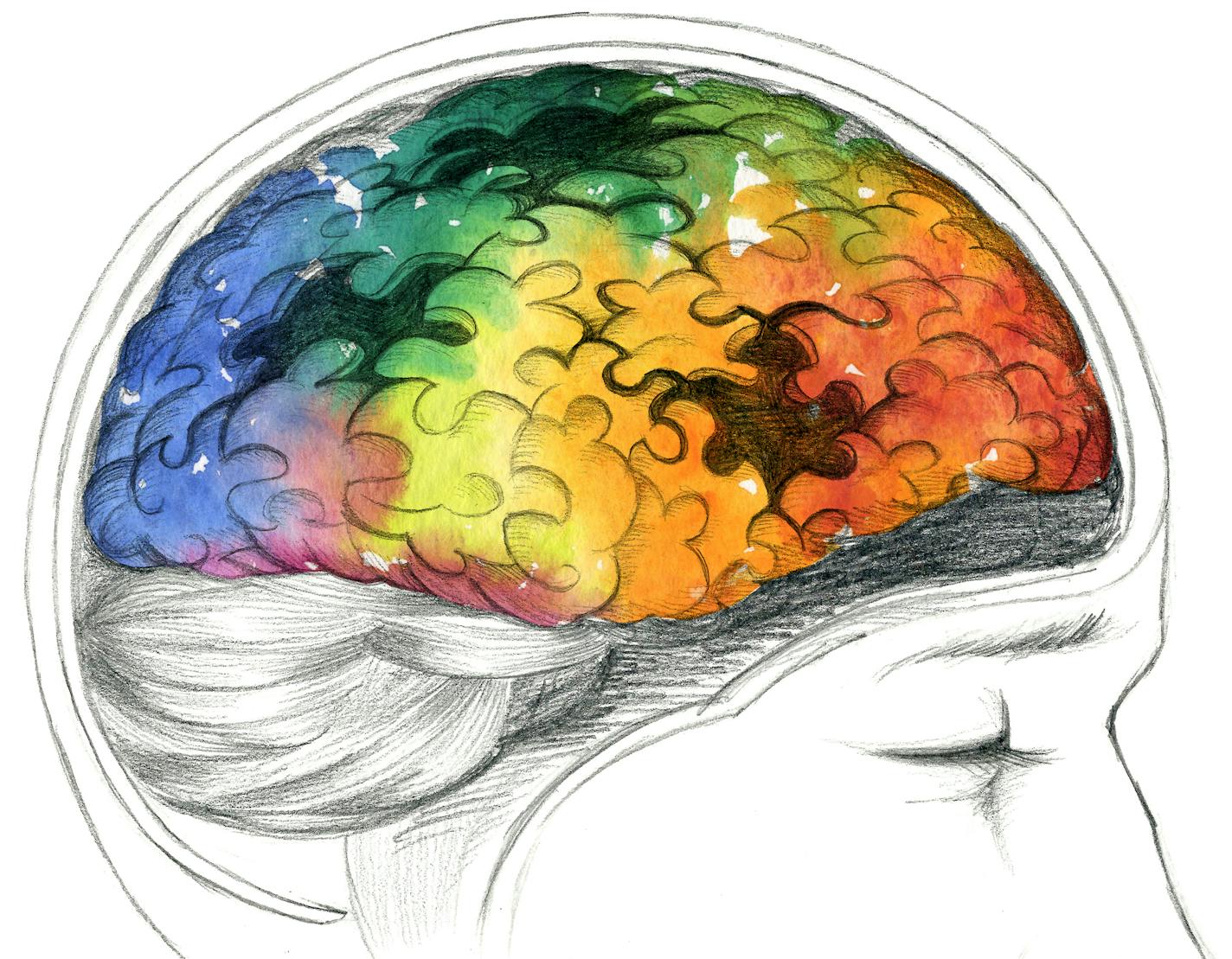 Human brain with Alzheimer's disease or other cerebral problem. Illustration hand made with pencil with digital color watercolored effects. istock