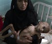 Bassam Mohammed Hassan, who suffers from severe malnutrition and cerebral palsy, is held by Madiya Ahmad, 70, at a hospital in Sanaa, Yemen, on Oct. 1