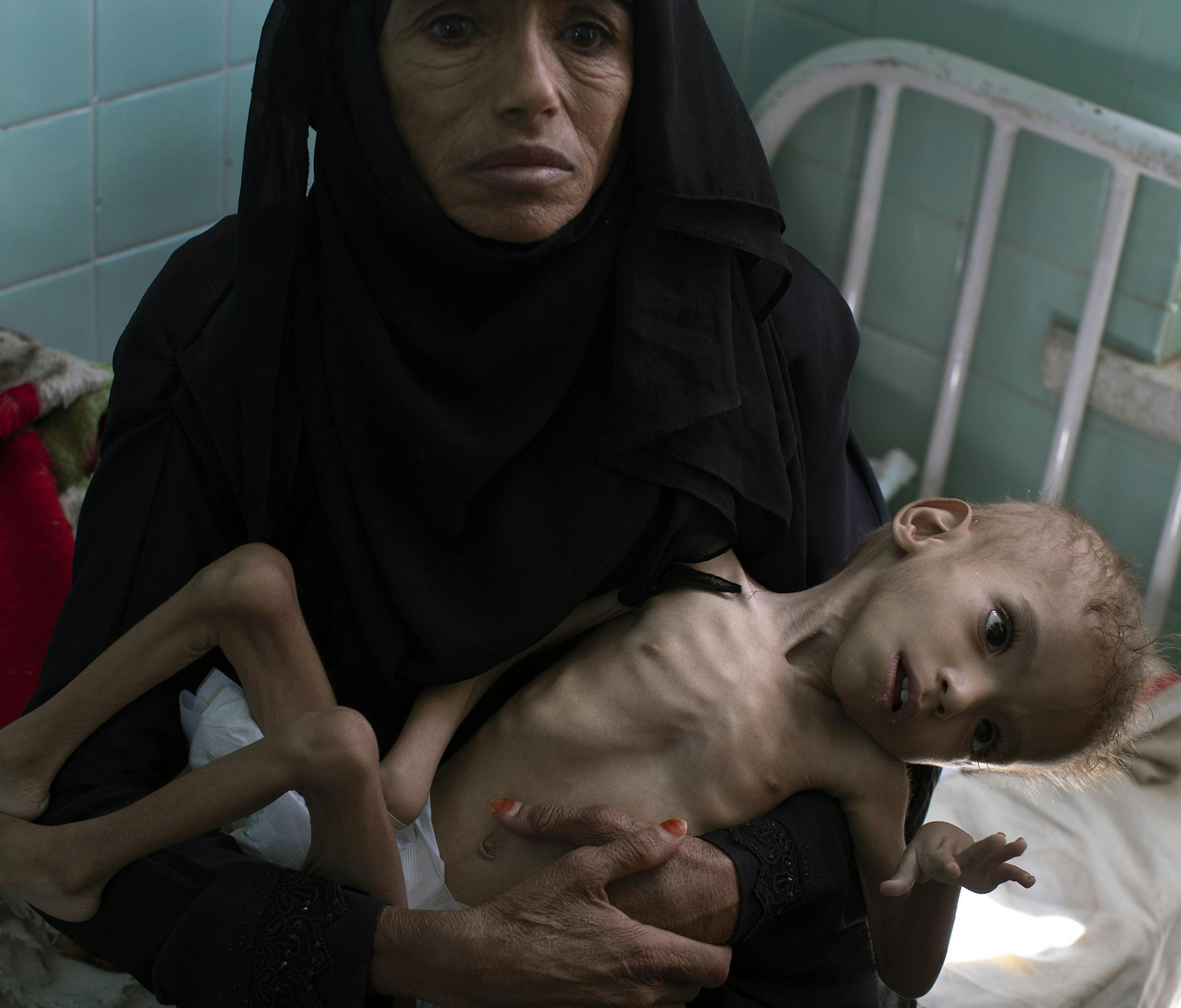 Bassam Mohammed Hassan, who suffers from severe malnutrition and cerebral palsy, is held by Madiya Ahmad, 70, at a hospital in Sanaa, Yemen, on Oct. 15, 2018. The Saudi-led war in Yemen has pushed millions to the brink of starvation. (Tyler Hicks/The New York Times)