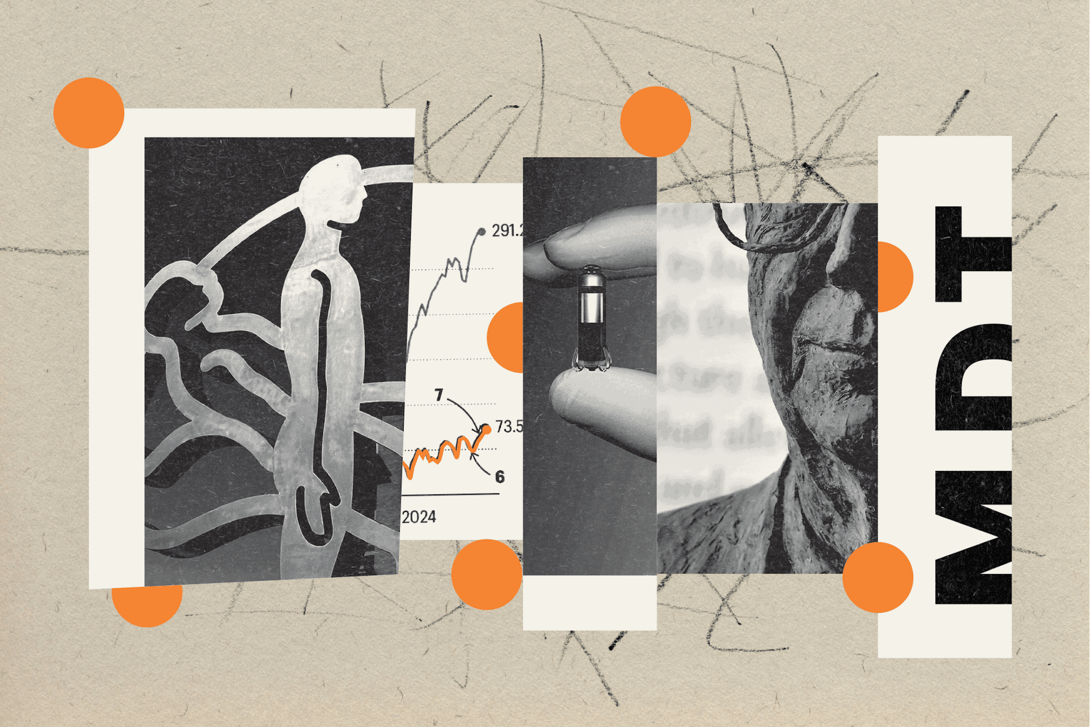 A collage of black and white images including the Medtronic logo, a fever chart showing stock prices, a pacemaker and a smiling man.