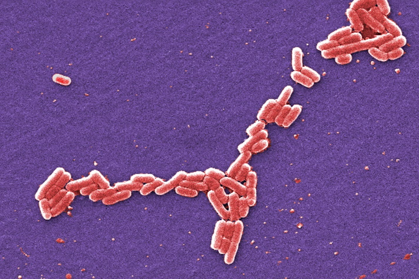 This colorized 2006 scanning electron microscope image made available by the Centers for Disease Control and Prevention shows E. coli bacteria of the O157:H7 strain that produces a powerful toxin which can cause illness. On Wednesday, May 2, 2018, U.S. health officials said California reported the first death in a national food poisoning outbreak tied to E. coli and romaine lettuce grown in Yuma, Ariz., which provides most of the romaine sold in the U.S. during the winter. (Janice Haney Carr/CDC