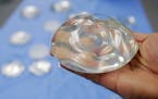 A silicone gel breast implant. More breast cancer survivors are forgoing implants.