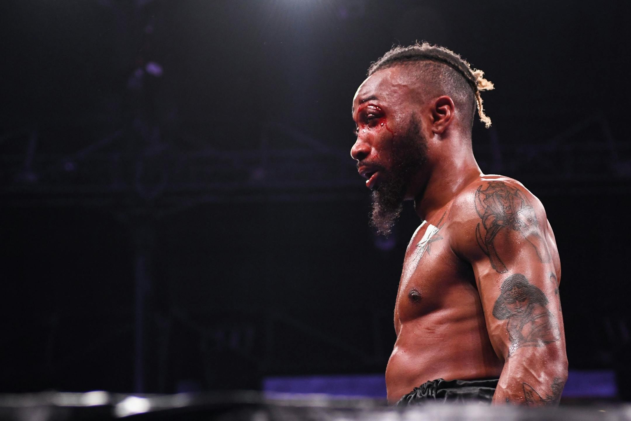 Ve Shawn Owens took a breath as blood dripped down his face from his fight against Alexis Gaytan.