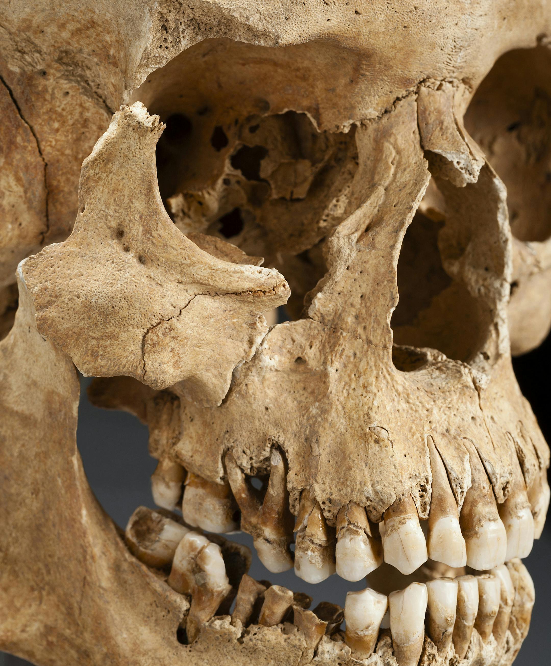 A male skeleton of African ancestry was found at Avery's Rest, a late 17th century plantation in Rehoboth, Delaware. MUST CREDIT: Kate D. Sherwood/Smithsonian Institution.