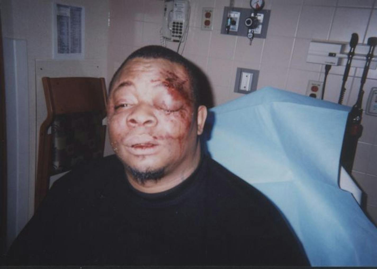 Derryl M. Jenkins as photographed at North Memorial Medical Center by a Minneapolis Police officer on Feb. 19, 2009, at North Memorial Medical Center in Robbinsdale. Jenkins said he needed seven stitches above his left eye and two teeth were broken after a traffic stop and confrontation with police. Photograph provided by lawyer Paul Edlund.