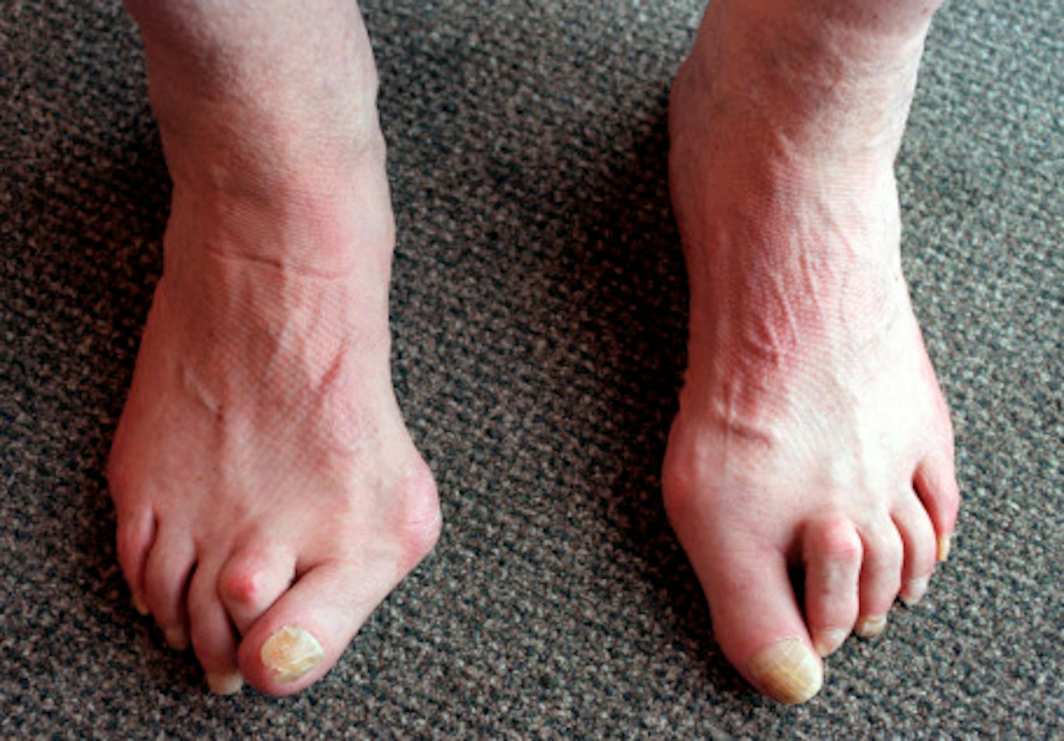 GENERAL INFORMATION: Bloomington, Mn., Sat., Apr. 21, 2001--Fitting a new pair of boots (hiking, climbing) at REI. Its more complicated than you think.