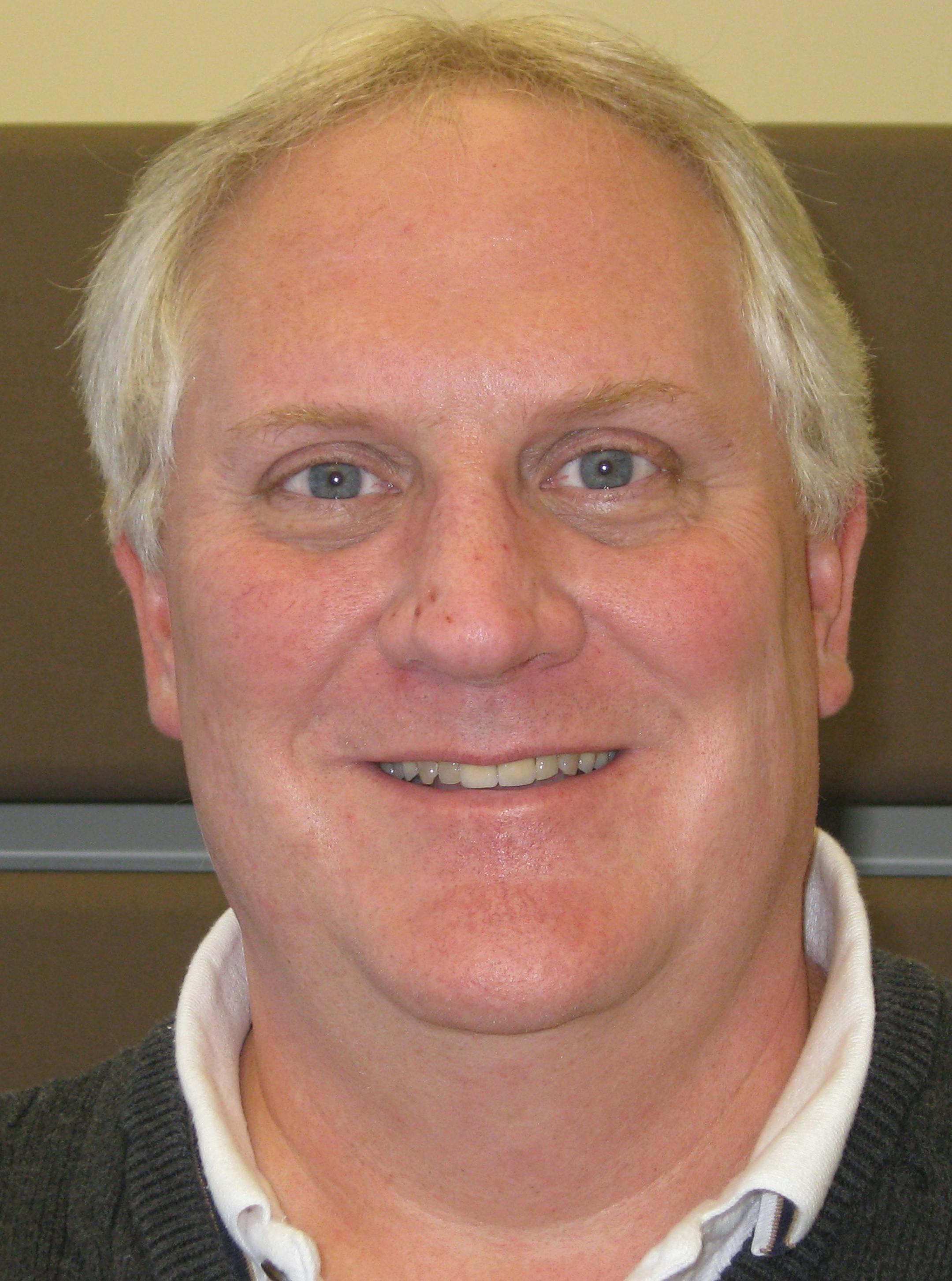 Randy Quale, manager of Bloomington's Parks and Recreation Division.