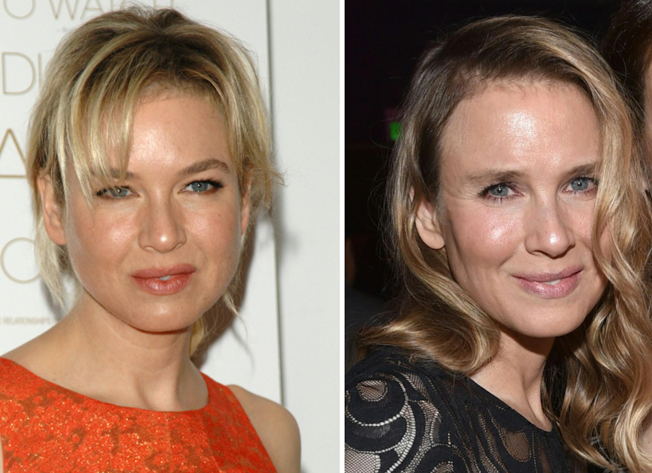Actress Renee Zellweger is shown in 2009, left, and this week at a Hollywood event.