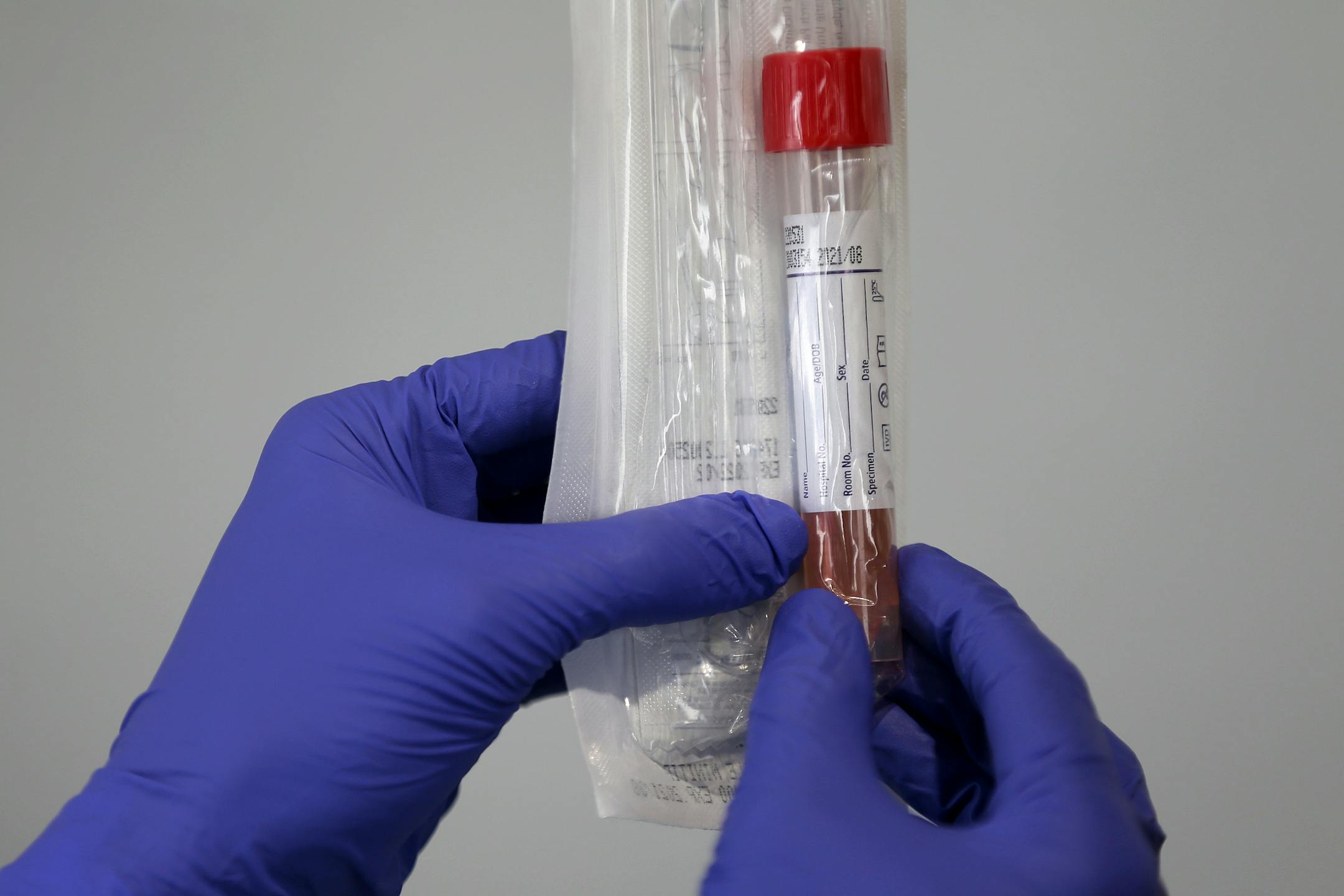 A universal viral transport kit.