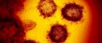 FILE - This undated electron microscope image made available by the U.S. National Institutes of Health in February 2020 shows the Novel Coronavirus SA