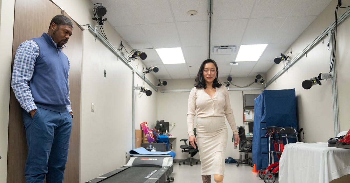 This prosthetic leg can wear high heels