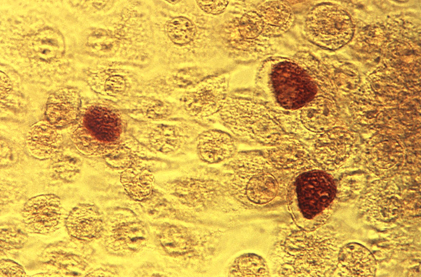 Chlamydia trachomatis bacteria magnified 200 times. While there were more cases of chlamydia (24,535) and gonorrhea (8,063) in 2019, the one-year increase in syphilis cases impacted the overall increase in STDs.