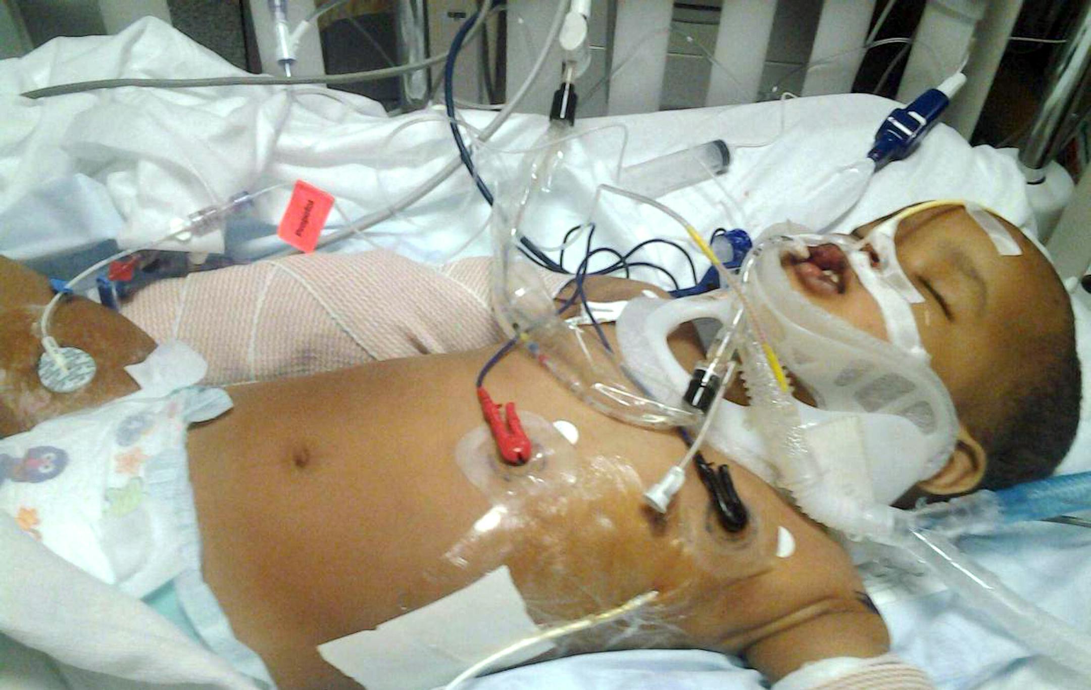 15-month-old Musa Dayib