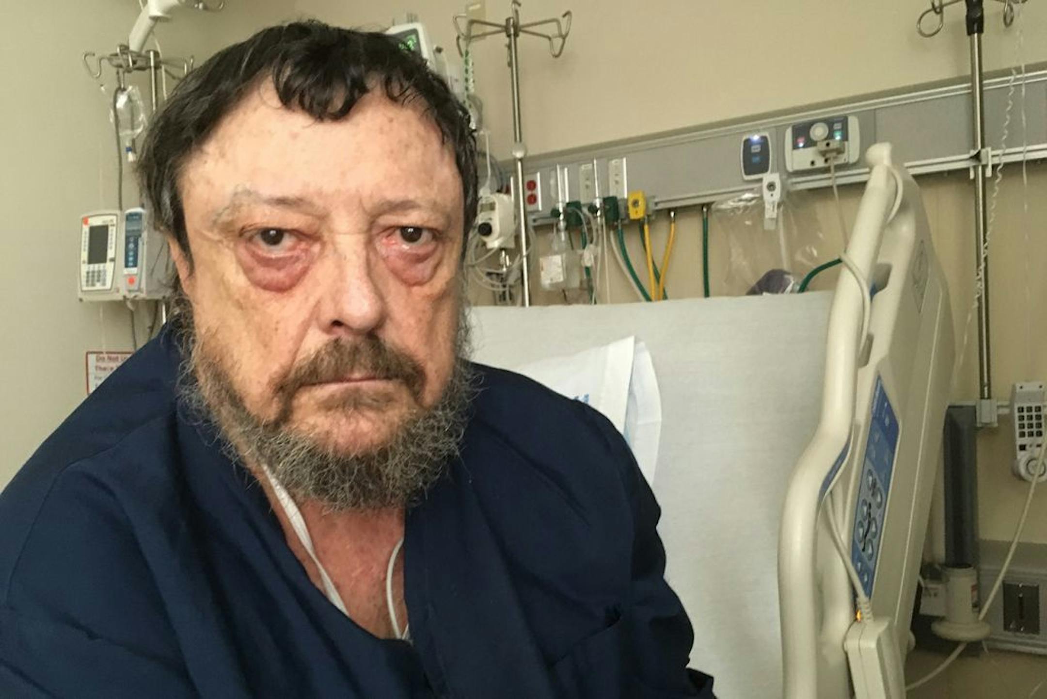 Ron Fleming, a helicopter door gunner in the Vietnam War, landed in the veterans hospital in San Francisco recently because of an asthma attack. Fleming has PTSD but told his doctors he doesn't want to take "happy pills" that may dull the emotional connection he has to his wartime past.