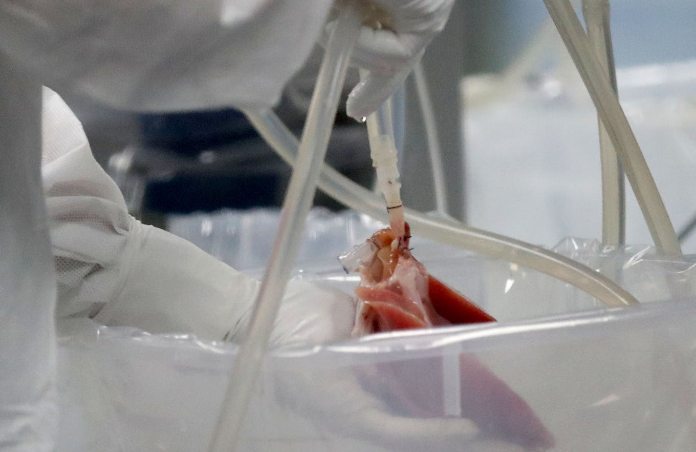 Miromatrix is a medical device company which is getting ready to run a clinical trial to test a lab-grown liver that can be transplanted into a human. Here a scientist checks a pig liver, among about three dozen newly arrived pig livers that were being decellularized at the medical device company headquarters Tuesday, Aug. 1, 2017, in Eden Prairie, MN.] DAVID JOLES &#x2022; david.joles@startribune.com Miromatrix is a medical device company which is getting ready to run a clinical trial to test a