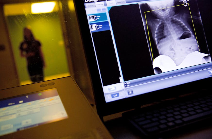 FILE- In this Feb. 9, 2018, file photo, a radiology technician looks at a chest X-ray of a child suffering from flu symptoms at Upson Regional Medical Center in Thomaston, Ga. A nasty flu season and fresh insurance deductibles may combine this winter to smack patients around the country with expensive medical bills. (AP Photo/David Goldman, File) ORG XMIT: NYBZ310