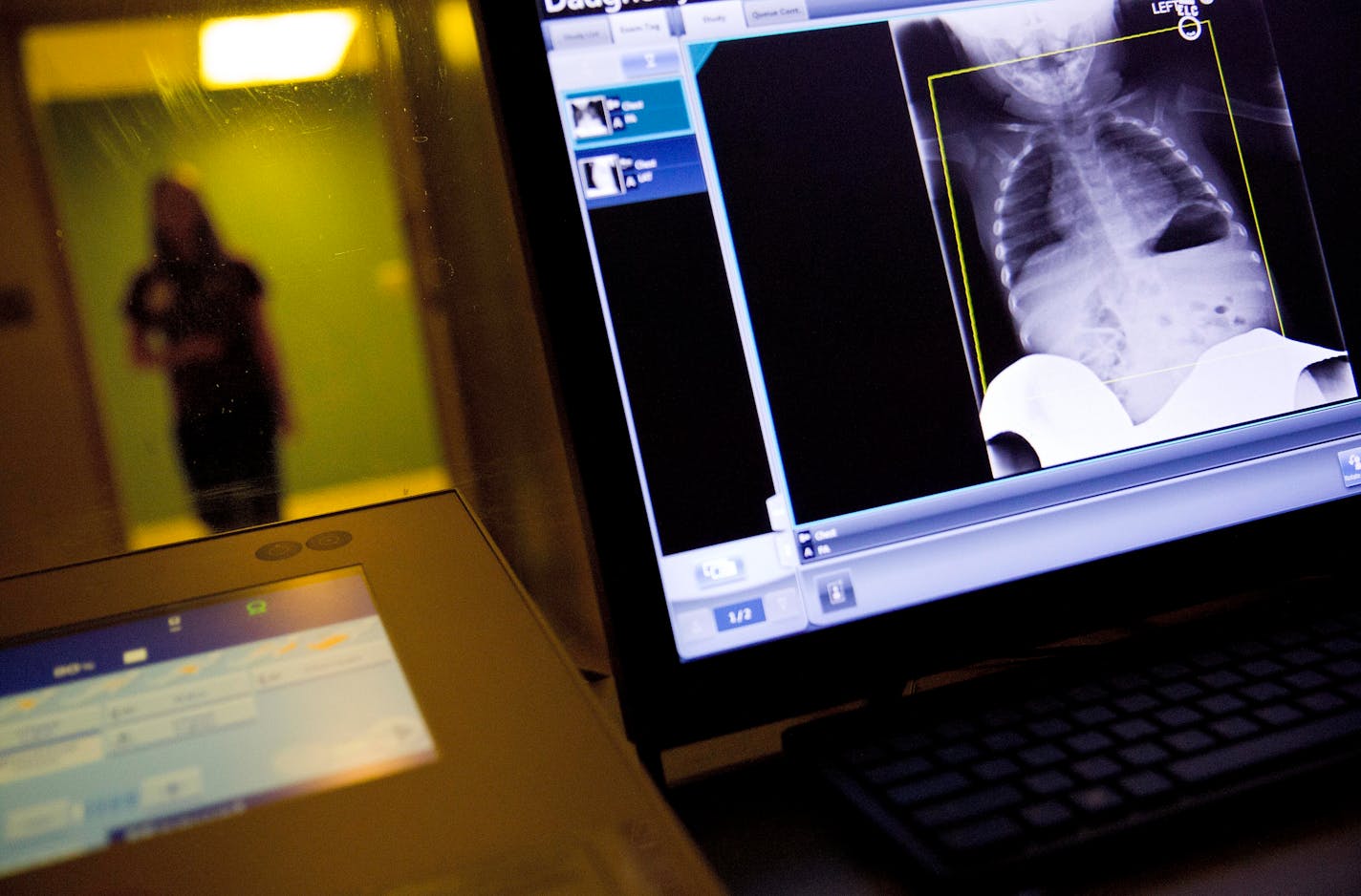 FILE- In this Feb. 9, 2018, file photo, a radiology technician looks at a chest X-ray of a child suffering from flu symptoms at Upson Regional Medical Center in Thomaston, Ga. A nasty flu season and fresh insurance deductibles may combine this winter to smack patients around the country with expensive medical bills. (AP Photo/David Goldman, File) ORG XMIT: NYBZ310