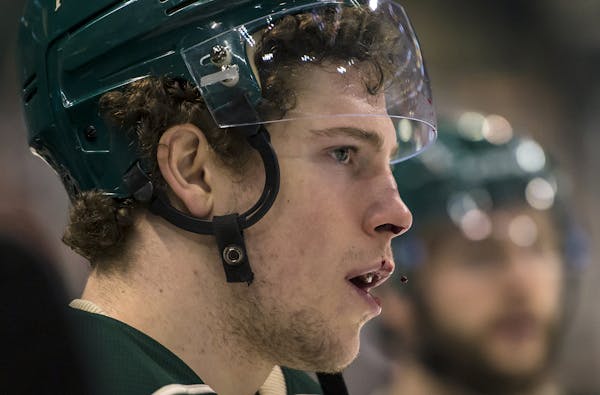 Blood dripped from the nose of Wild center Charlie Coyle after taking a high stick from Blackhawks defenseman Duncan Keith in the first period Tuesday