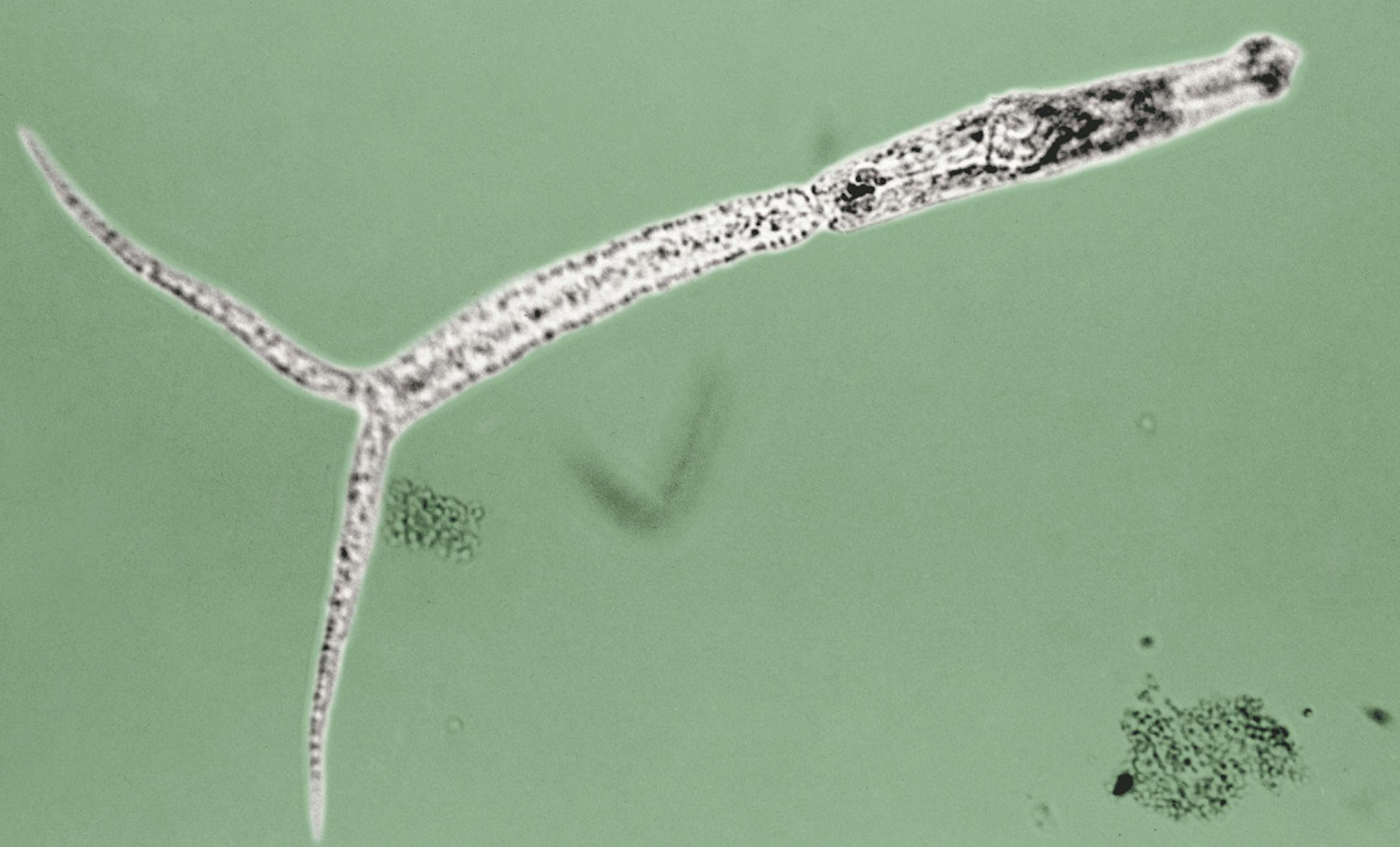 COLORIZED FOR ILLUSTRATION PURPOSES This historic 1942 photomicrograph revealed some of the morphologic details displayed by a schistosomal cercaria, which is the larval stage of a parasite that causes &#x201c;swimmer&#x2019;s itch&#x201d;, and was magnified approximately 150x. Photo credit: CDC/ Minnesota Department of Health, R.N. Barr Library.