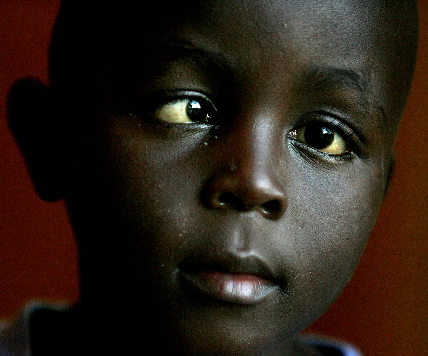 ELIZABETH FLORES &#xa5; eflores@startribune.com March 25, 2010 - Lakeville, MN ] IN THIS PHOTO: Six-year-old Moses Mwaura made himself comfortable at the home of Tim and Cindy Murphy of Lakeville, MN. Mwaura of Nairobi, Africa is in the Twin Cities thanks to a local Rotary Club International member Sandy Schley of Edina, who met Moses in a slum two years ago during a trip there. He is here now to get his eyes repaired. Tim Murphy, also a Rotary member, brought Moses home with him after being in