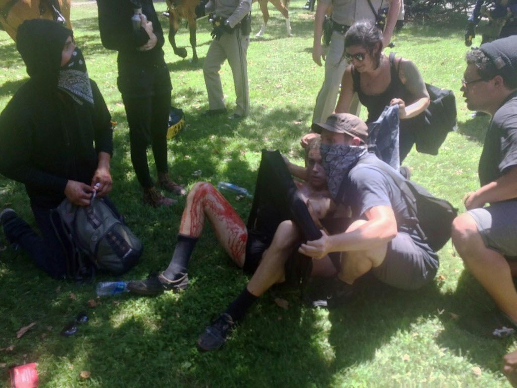 An injured anti-fascist protester lies on the ground with fellow demonstrators after a clash with members of white supremacist and other right-wing extremist groups who were holding a rally in Sacramento, Calif. California Highway Patrol officers managed to break up the large fight in which several people were stabbed.