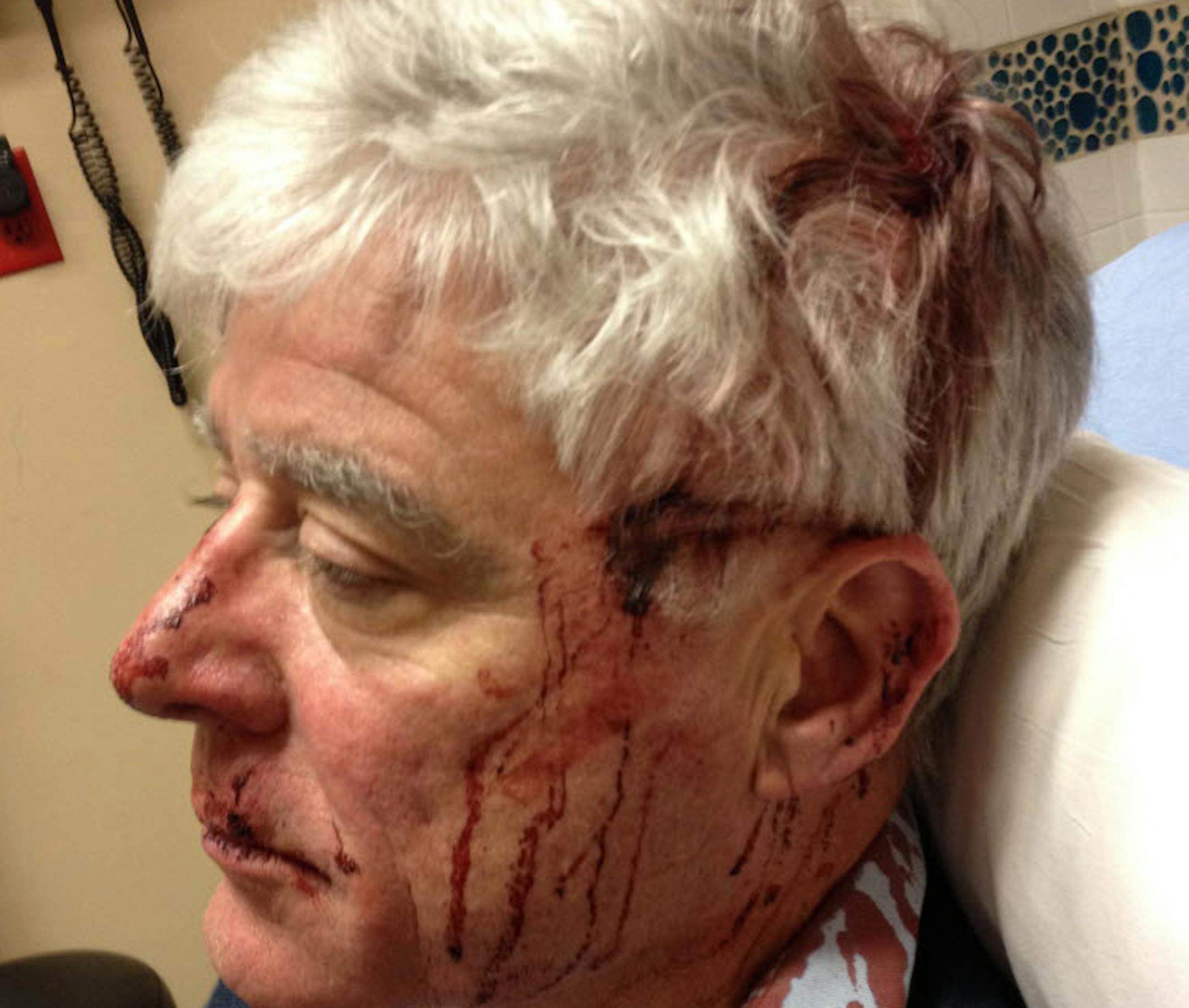 Mark Andrew at the hopsital after being attacked at the Mall of America.