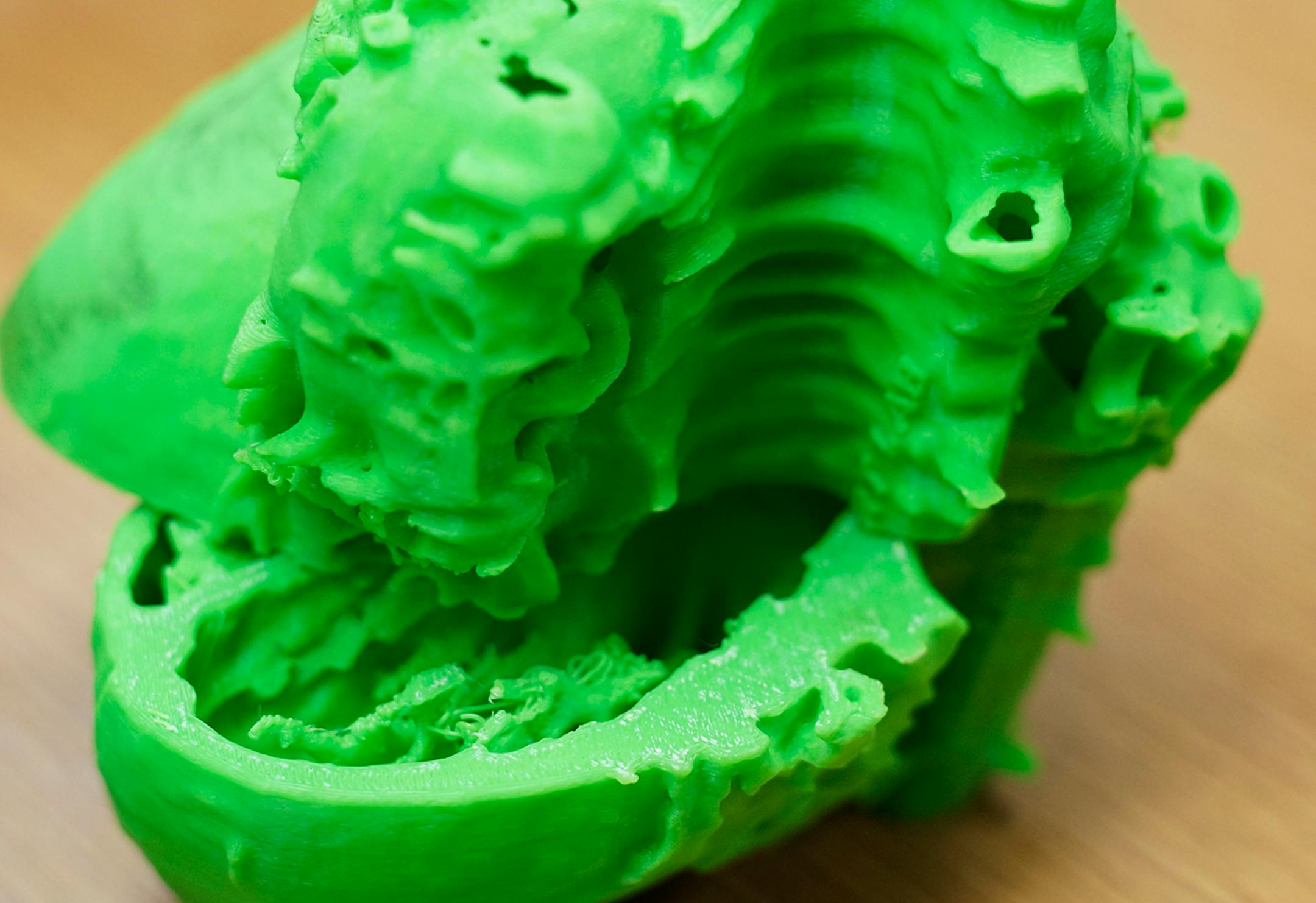 At the Visible Heart Research laboratory on the U of M campus, a model of the human heart is made using a 3D printer before a surgeon operates on the patient.