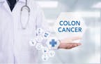It's important to get recommended colon cancer screenings beginning at age 50.