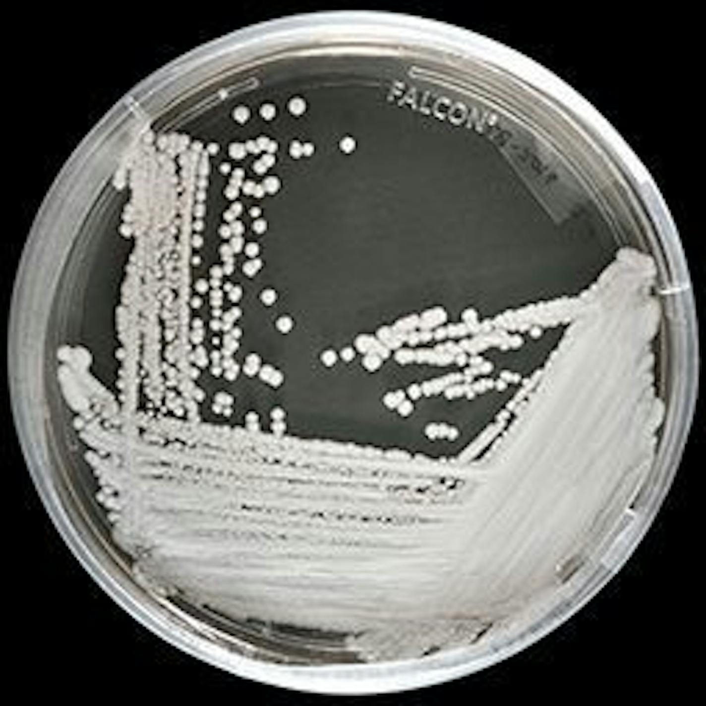 A strain of Candida auris cultured in a petri dish at the Centers for Disease Control and Prevention. MUST CREDIT: Centers for Disease Control and Prevention