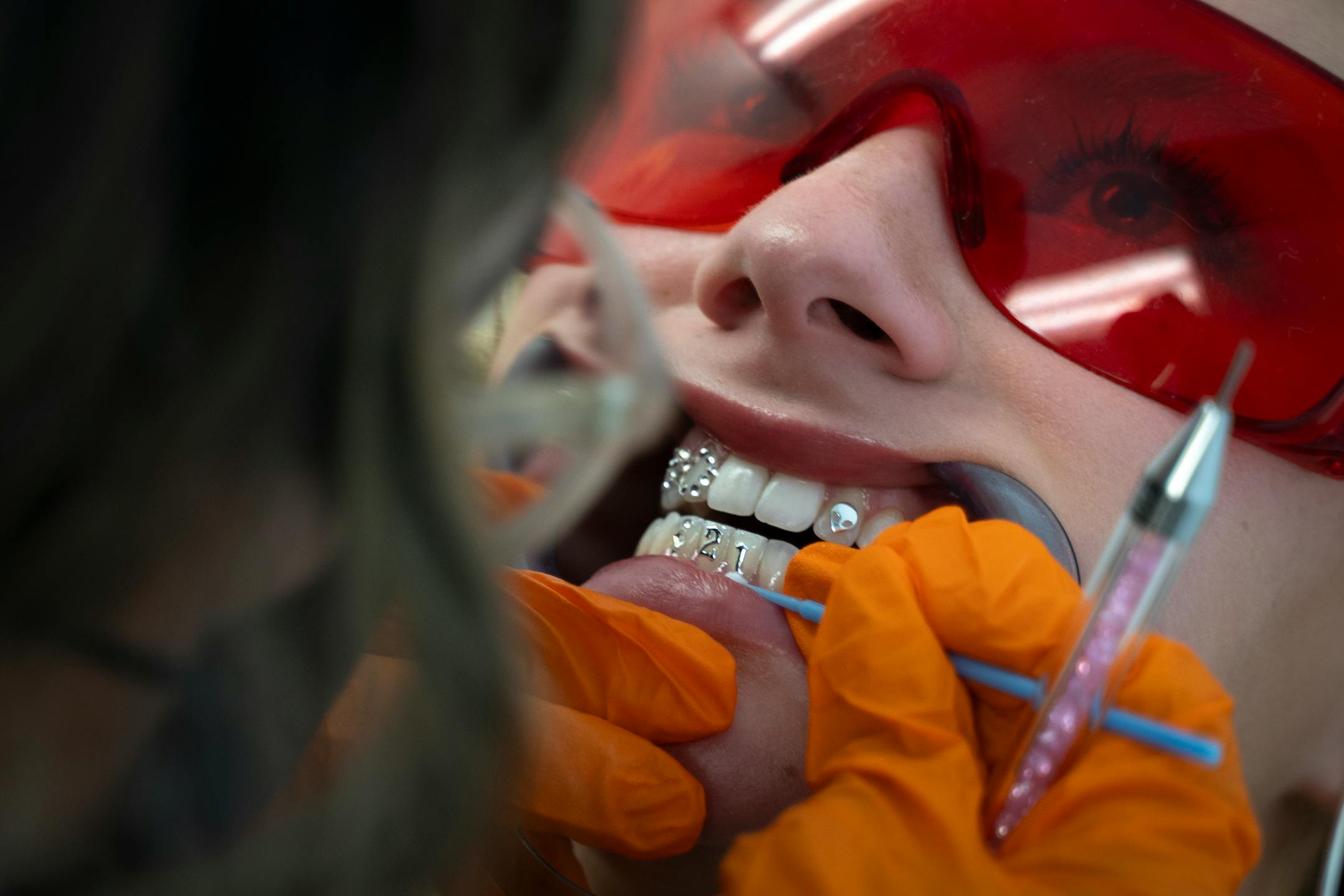 Mirna Lovo, owner of Pearly Whites MN, applies tooth gems spelling "21" to Josie Wicka in honor of Wicka's recent 21st birthday in Burnsville, Minn. on Thursday, June 29, 2023.