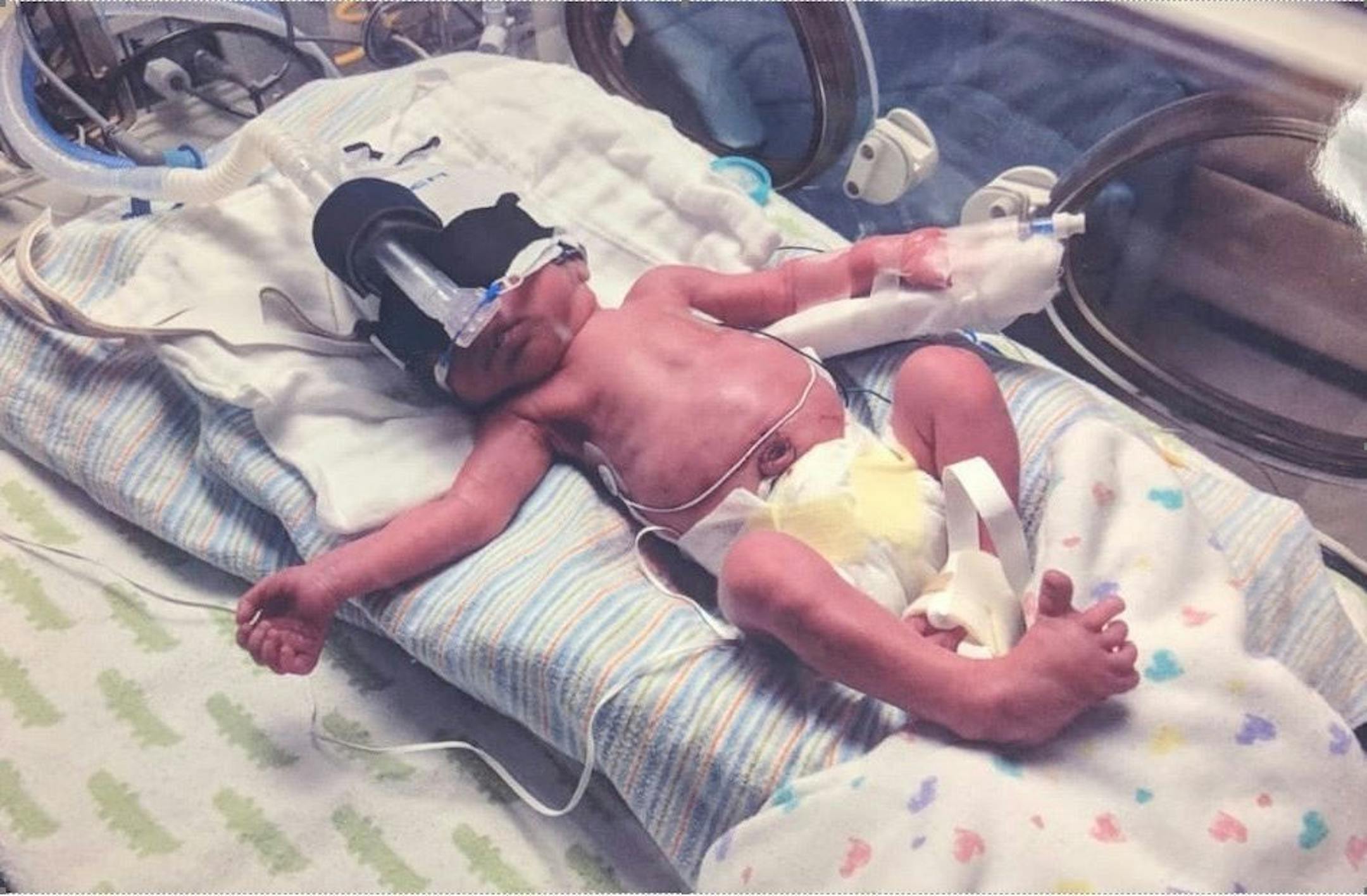 Baby Oliver was born 10 weeks into the federal shutdown. His father, an air traffic controller from Lakeville who is now on unpaid furlough, has been unable to change his health insurance to cover Oliver's due to the shutdown.