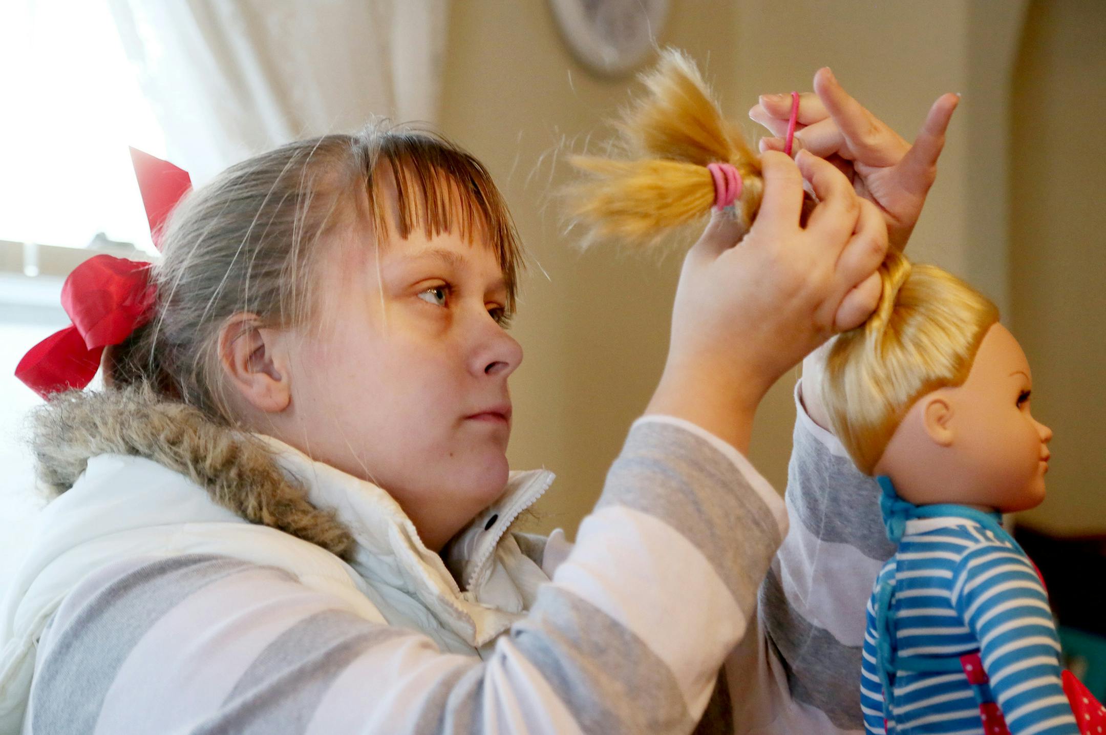 Here, Brianna, 18, who enjoys crafts and got this doll for Christmas, braids the doll's hair next to her mom Candy Hoover, not pictured, at home Thursday, Feb. 12, 2015, in Cambridge, MN. Brianna and her brother Cory are twins and both have fetal alcohol syndrome and have lived with foster mom Candy Hoover, who has since adopted them. They have severe mental impairments, and need help with their homework and even basic tasks, such as buttoning their shirts. However, Brianna is unable to live mor