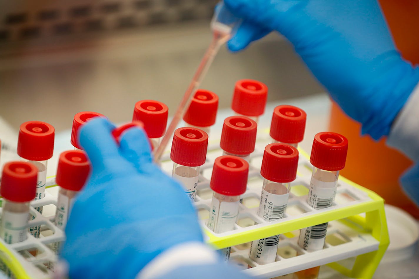 A technician prepares COVID-19 coronavirus patient samples for testing at a laboratory in New York's Long Island.