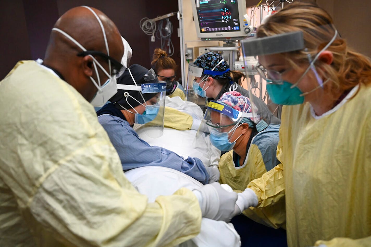 Critical care nurses and respiratory therapists flipped a patient with COVID-19 upright at North Memorial Health Hospital in Robbinsdale on Monday.