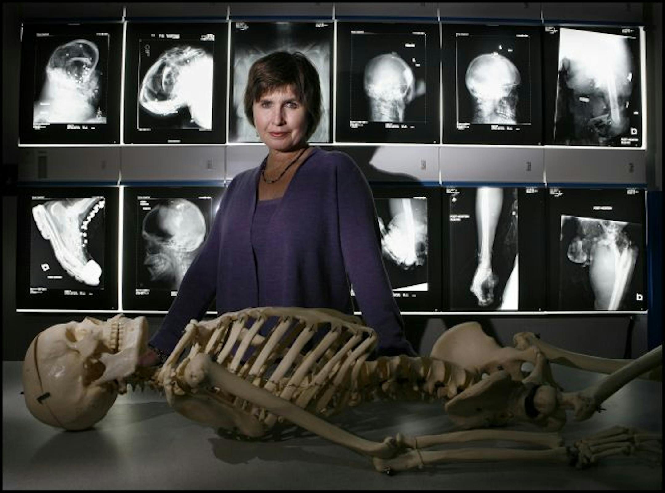 Dr. Janis Amatuzio, Anoka County medical examiner, says for the first time she is hearing surviving family members tell stories of job loss or foreclosure that may have led to their loved ones killing themselves. Other medical examiners are reporting similar experiences.