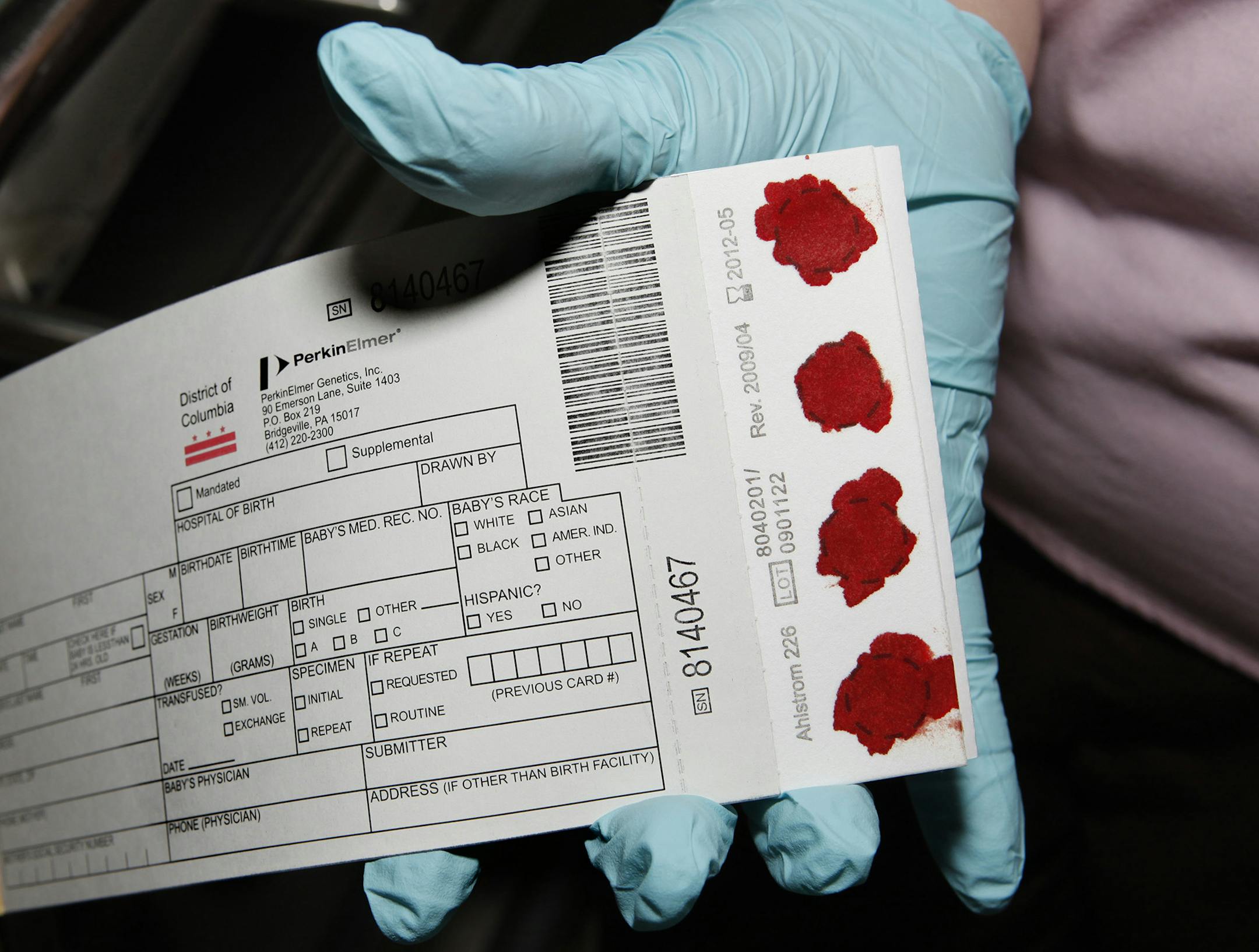 A card is displayed after checking a 1-day-old baby boy for a newborn screening to detect phenylketonuria (PKU) and many other disorders at the Washington Hospital Center in Washington, Friday, Feb. 5, 2010. A critical safety net for babies _ that heelprick of blood taken from every newborn _ is facing an ethics attack. States increasingly are storing the leftover blood samples for later medical research, often without parents' knowledge or consent _ prompting lawsuits in two states and work in